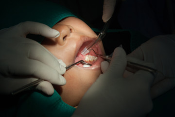 Dentists use dental oral treatment of patients.