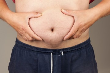 Naklejka premium Obese fat man. Man is holding his too fat tummy. Obesity health hazard. health care and people concept 