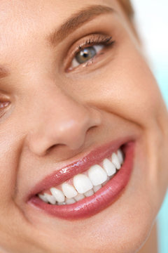 Beautiful Smile. Smiling Woman Face With White Teeth, Full Lips. High Resolution Image