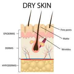 Obraz premium Illustration of The layers of dry skin