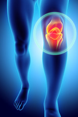 Knee painful - skeleton x-ray. - obrazy, fototapety, plakaty