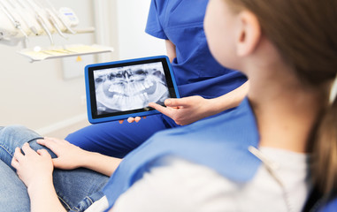 dentist showing x-ray on tablet pc to patient girl