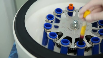 Platelet-Rich plasma preparation. Medical tube with blood plasma for PRP in centrifuge in medical clinic. Plasmolifting.