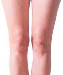 Woman knees isolated on white