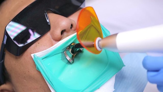 Solidification process of composite materials using polymerization apparatus, dental dam in oral cavity.