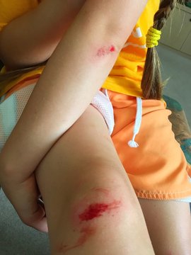 blessure