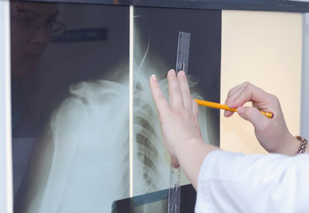 Brunette female doctor examining an x-ray
