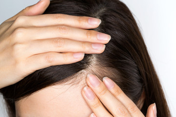 Fototapeta premium 頭皮ケア
