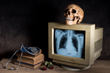 Still life photography : human skull with X-ray image of human spine and breastbone in monitor