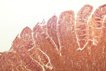 Villi of small intestine, light micrograph, magnification 40x