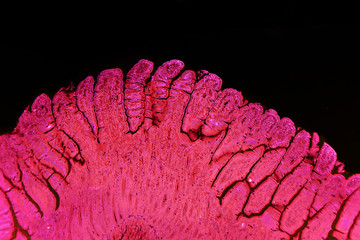 Villi of small intestine, light micrograph with enhanced colors to visualize inner structures,...