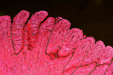 Villi of small intestine, light micrograph with enhanced colors to visualize inner structures,...