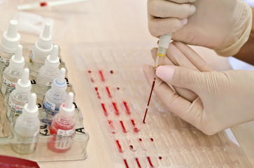 The process of determining the blood group and Rh factor