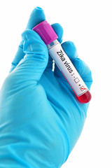 Fototapeta premium Blood sample positive with Zika virus