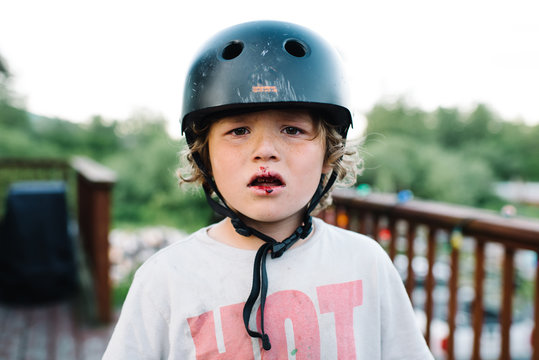 Young boy with bleeding mouth wearing crash helmet 
