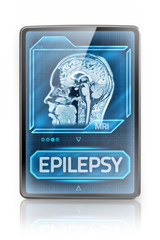 Tablet displaying diagnosis of epilepsy