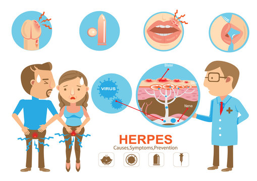 Herpes/Doctor holding diagram Herpes on the lips and genitals of the young woman And young men. Cartoon vector illustration And genitals