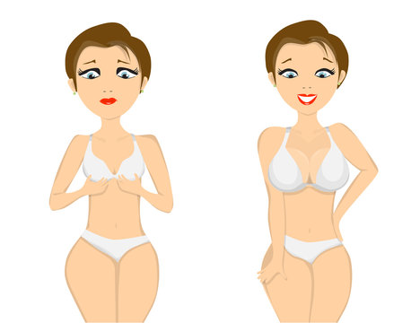 girl before and after breast augmentation on white background