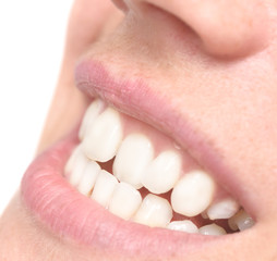 woman crooked teeth