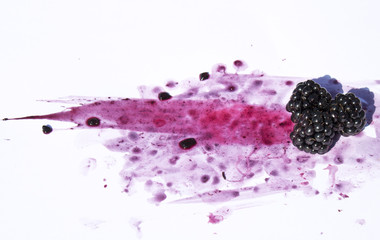 Blackberries Crushed and Squashed on White Background