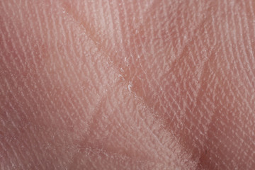 human skin