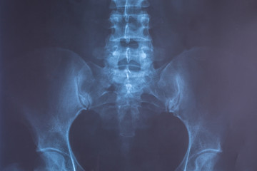 X-Ray image of human for a medical diagnosis