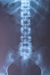 X-Ray image of human for a medical diagnosis