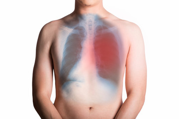 Man and an x-ray with lung isolated on white background.