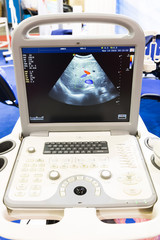 Colourful ultrasound machine womb