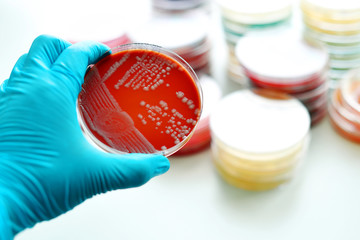 Bacteria culture in petri dish
