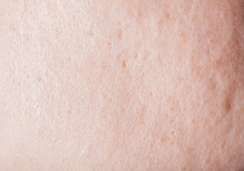 Human face skin texture
