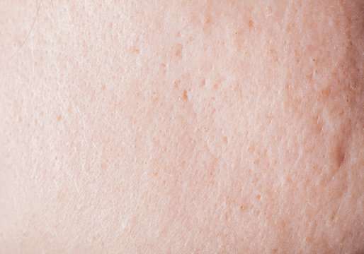 Human face skin texture