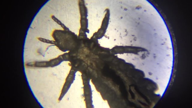 Louse inspected under the microscope