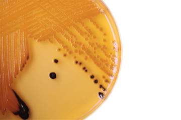 Black bacterial colonies of Salmonella species on Salmonella Shi