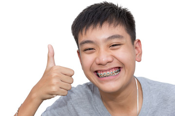 Beautiful smiling of handsome boy with teeth brace dental and great hand sign on isolated background.