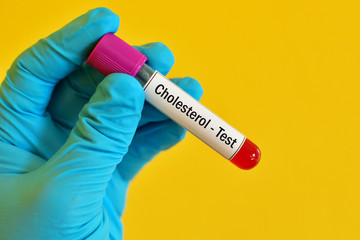 Blood sample for cholesterol test
