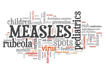 Measles
