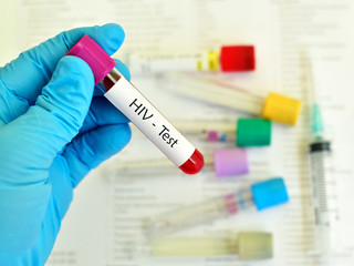 Naklejka premium Blood for HIV test