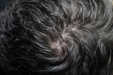 Macro of black hairs