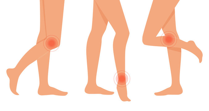 Pain in legs. Vector isolated illustration. Flat