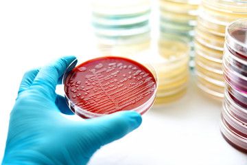 Colonies of bacteria in blood agar (culture medium plate)
