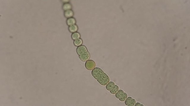 Green algae cells under microscope