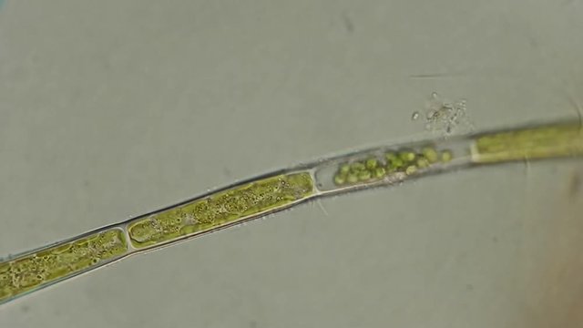 Green algae cells under microscope