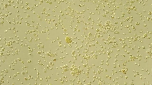Green algae cells under microscope