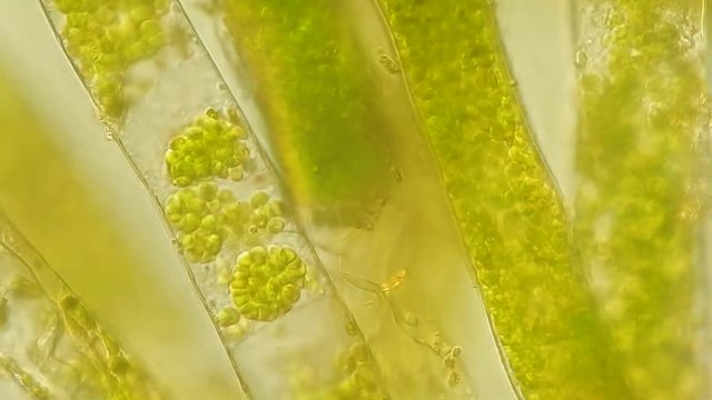 Seaweed (algae) under microscope, magnification 400x
