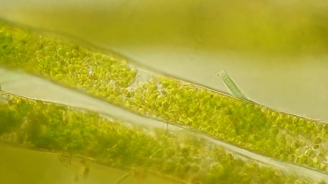 Seaweed (algae) under microscope, magnification 400x
