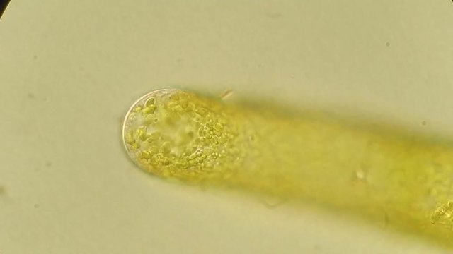 Seaweed (algae) under microscope, magnification 400x
