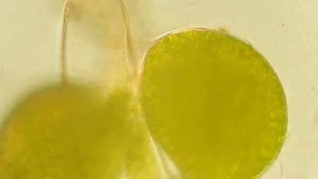 Seaweed (algae) under microscope, magnification 400x