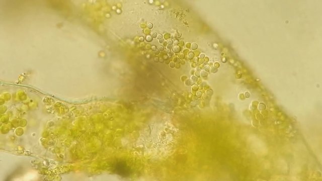 Seaweed (algae) under microscope, magnification 400x