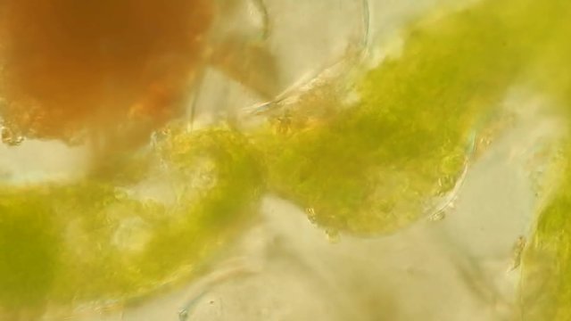 Seaweed (algae) under microscope, magnification 400x
